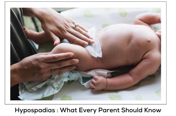 Hypospadias : What Every Parent Should Know