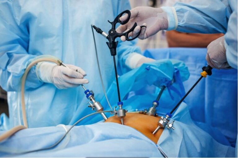 Pediatric Laparoscopic Surgery in Vasai-Virar