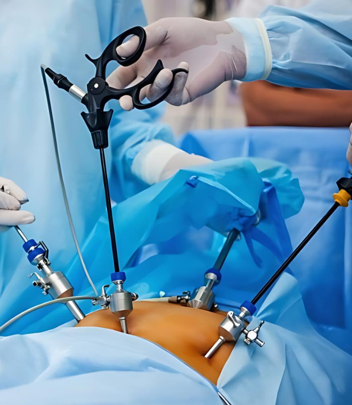 Pediatric Laparoscopic Surgery in Vasai-Virar