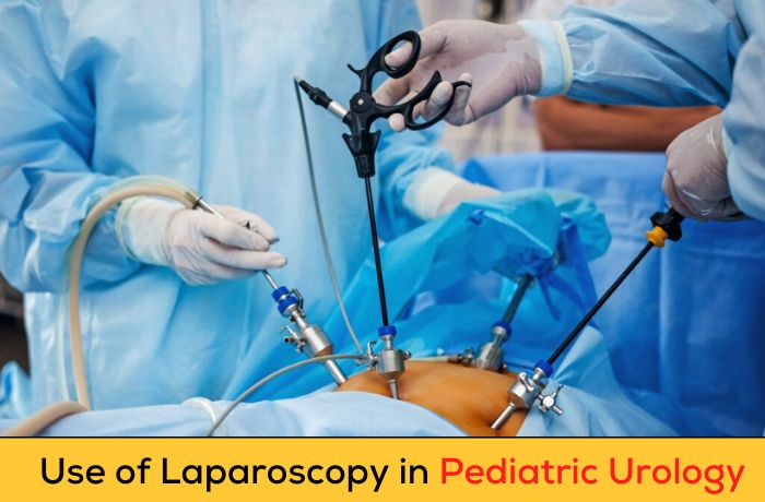 Use of Laparoscopy in Pediatric Urology