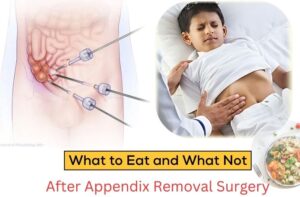 What to Eat and What Not- After Appendix Removal Surgery