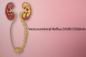 Vesicoureteral Reflux in Children