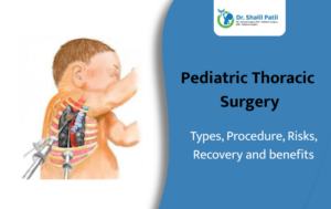 Pediatric Thoracic Surgery: Types, Procedure, Risks, Recovery & Benefits