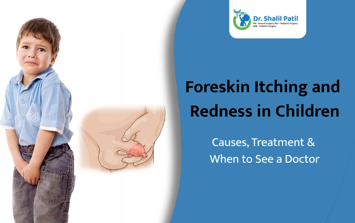 Foreskin Itching and Redness in Children: Causes, Treatment & When to See a Doctor