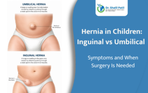 Hernia in Children: Inguinal vs Umbilical