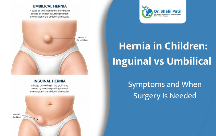Hernia in Children: Inguinal vs Umbilical